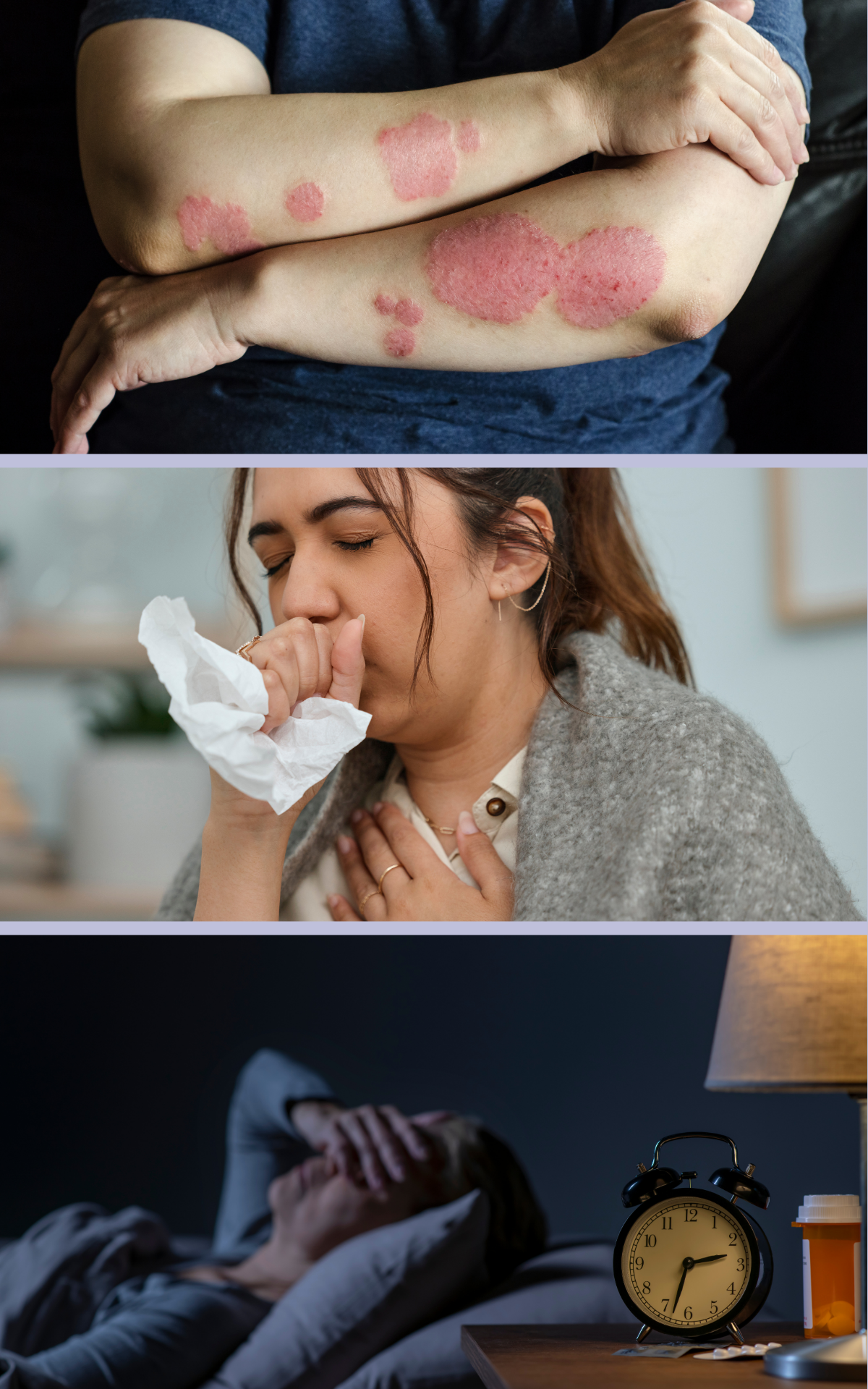 Symptoms of mast cell activation in long COVID