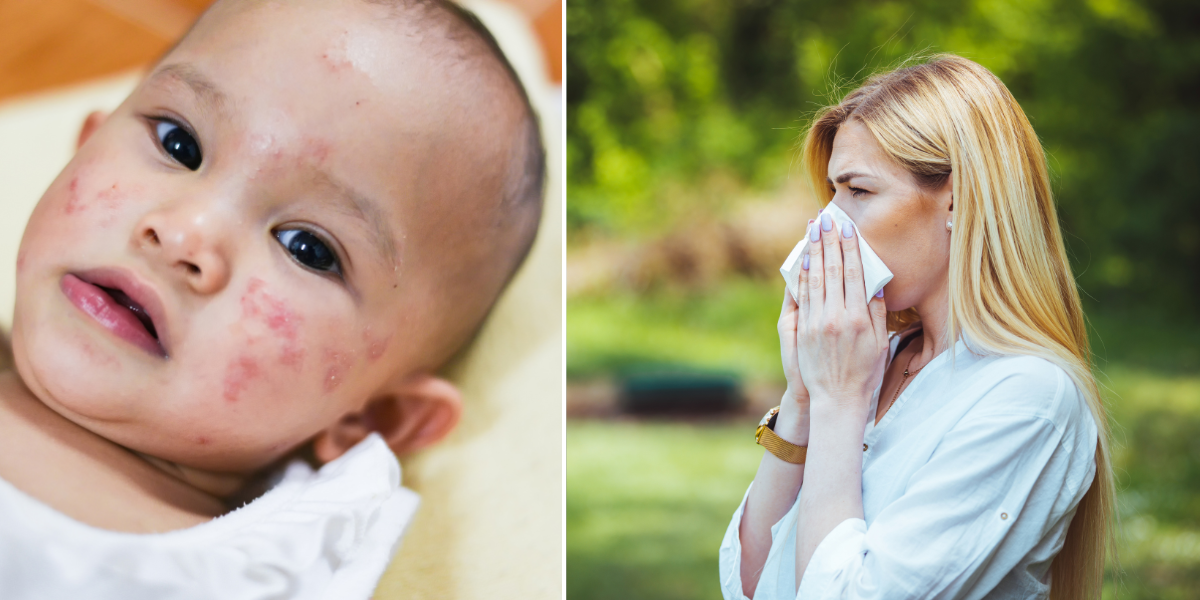 Baby with a red skin rash and a woman sneezing, showing mast cell activation symptoms
